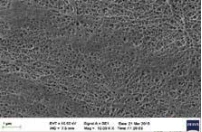 SEM comparator sample showing locally closed pores on the separator surface